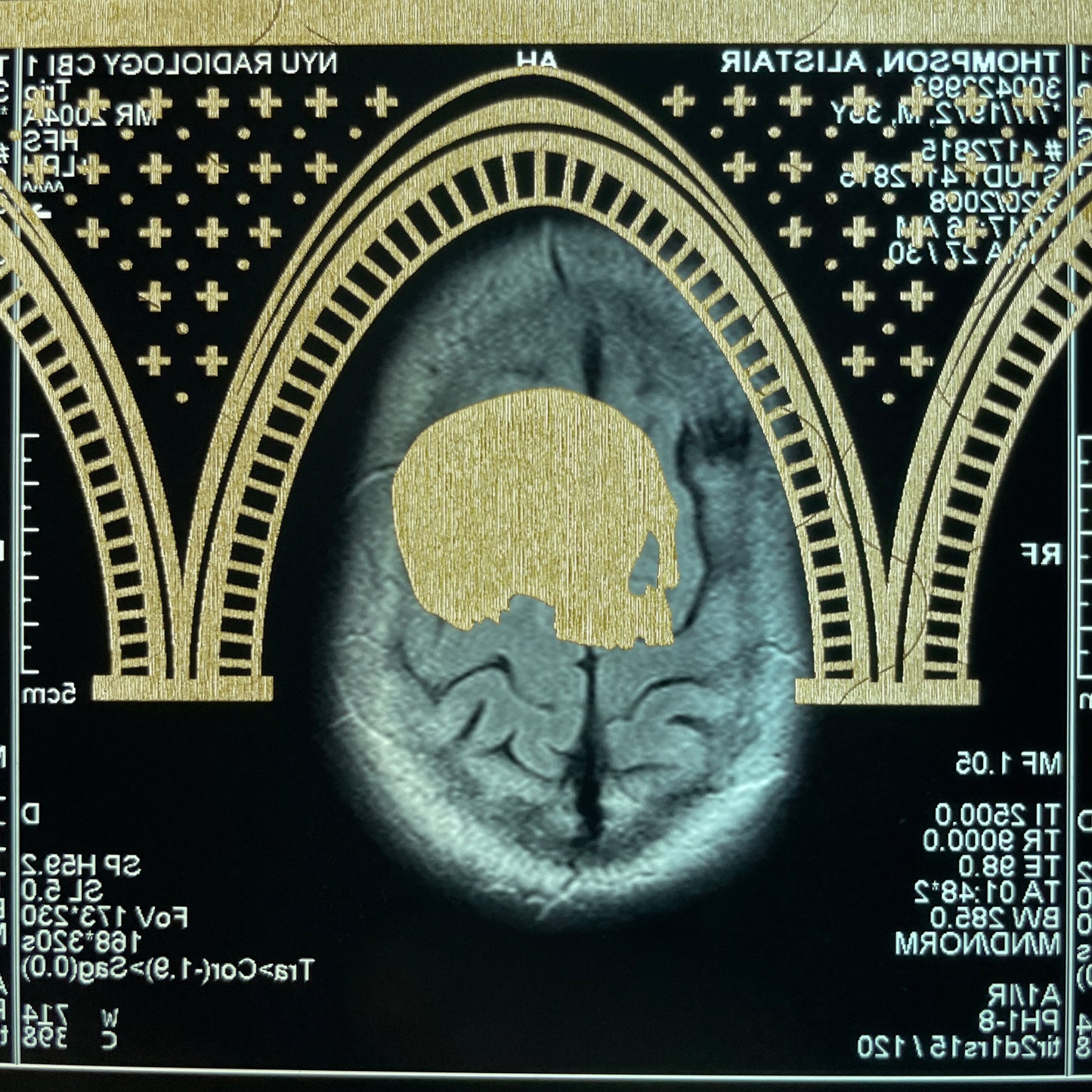 Mors Ianva Vitae Laser Etched MRI Print 2
