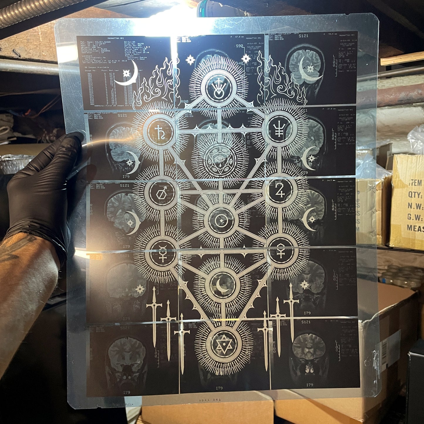 Sephiroth Laser Etched MRI Print 2