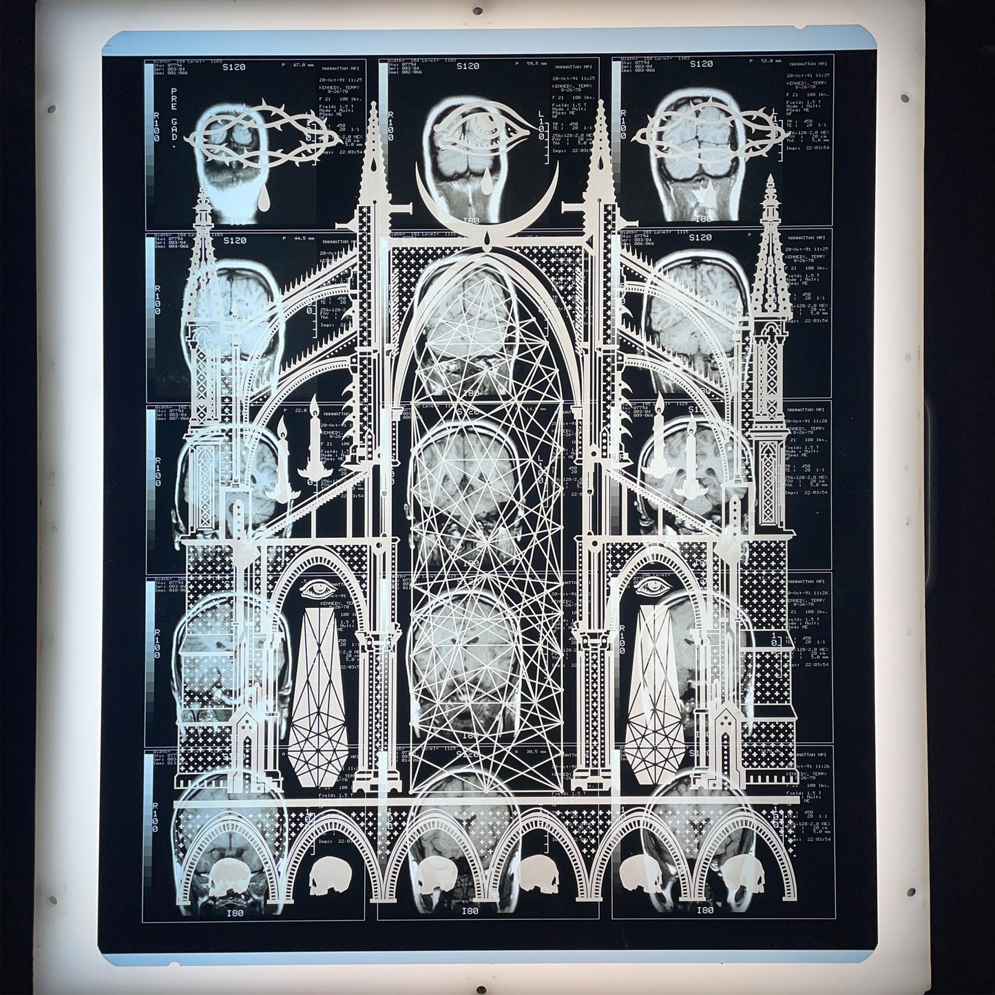 Mors Ianva Vitae Laser Etched MRI Print 1