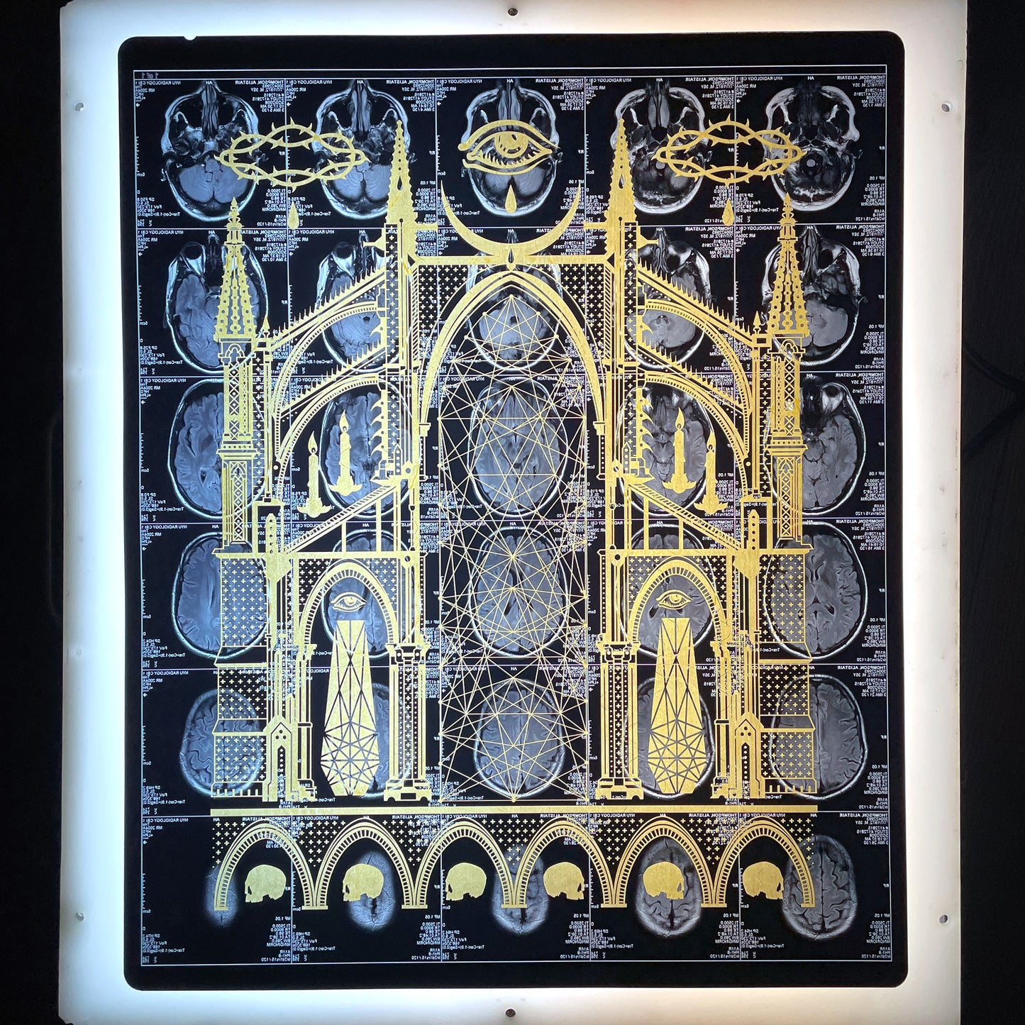 Mors Ianva Vitae Laser Etched MRI Print 2