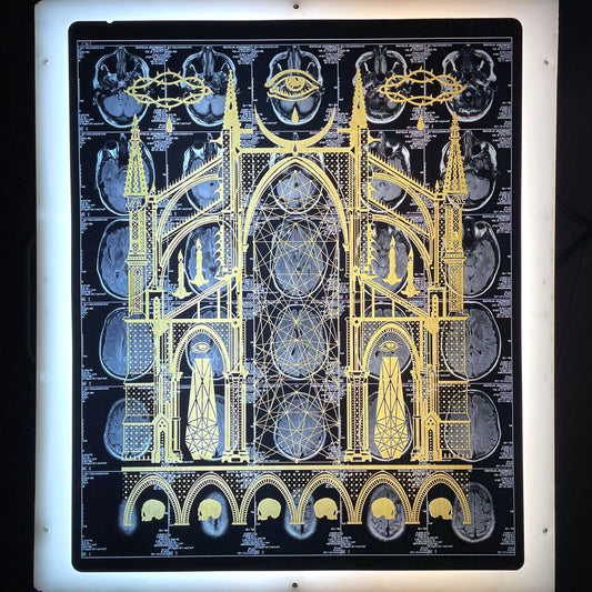 Mors Ianva Vitae Laser Etched MRI Print 2