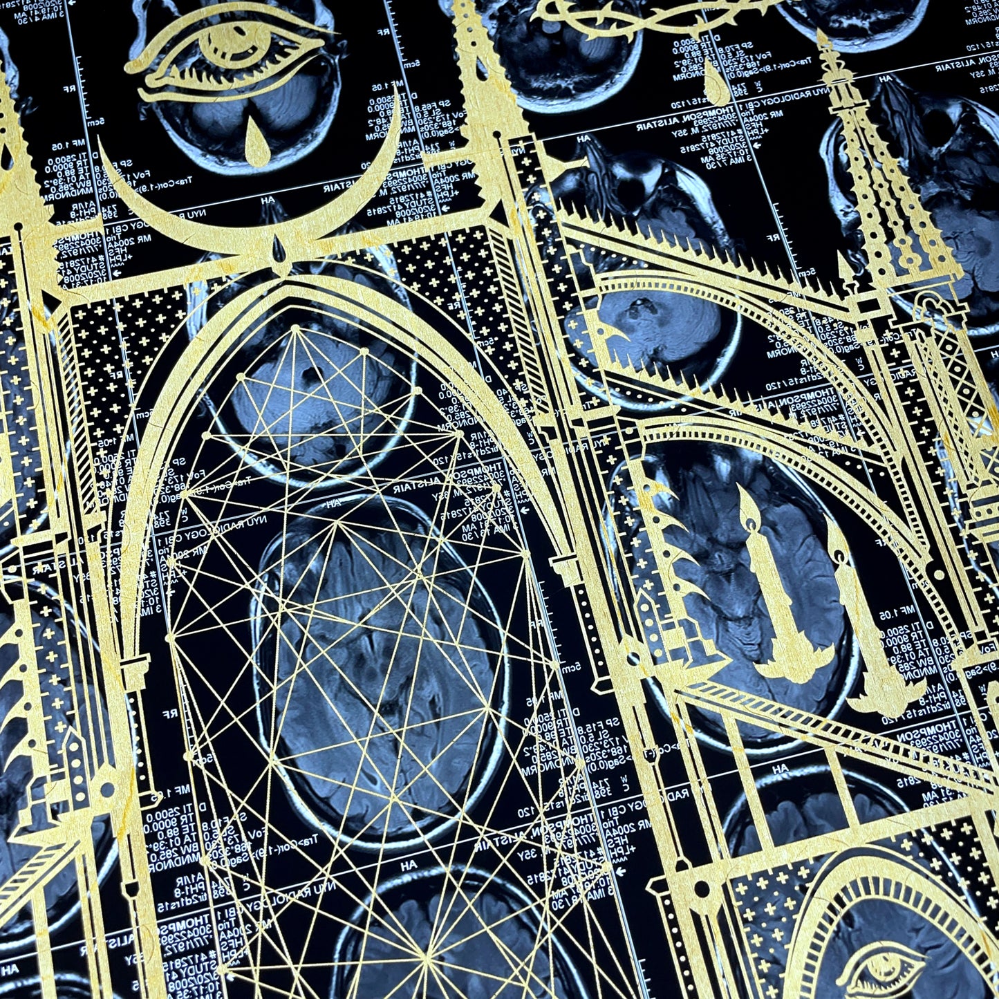 Mors Ianva Vitae Laser Etched MRI Print 2