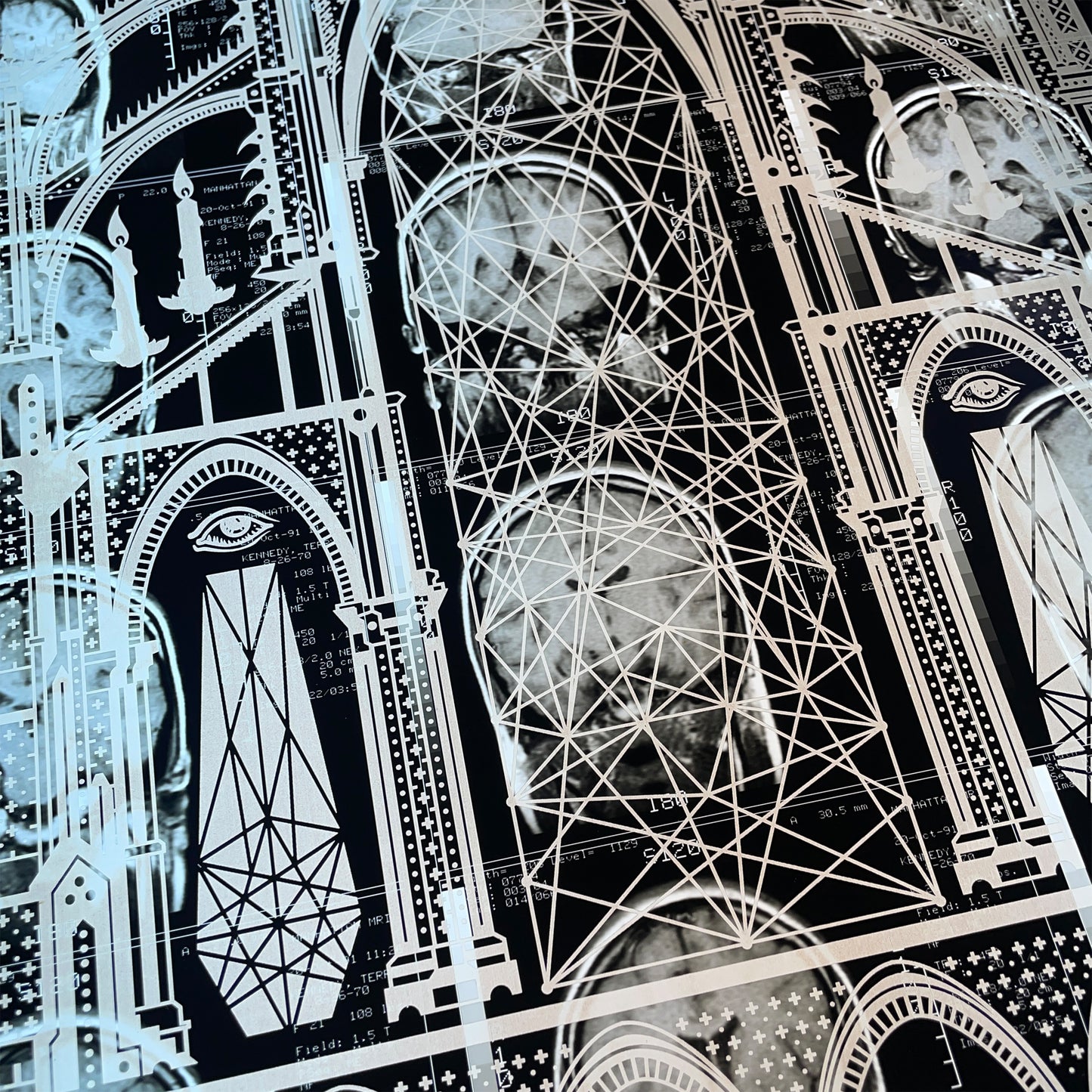 Mors Ianva Vitae Laser Etched MRI Print 1