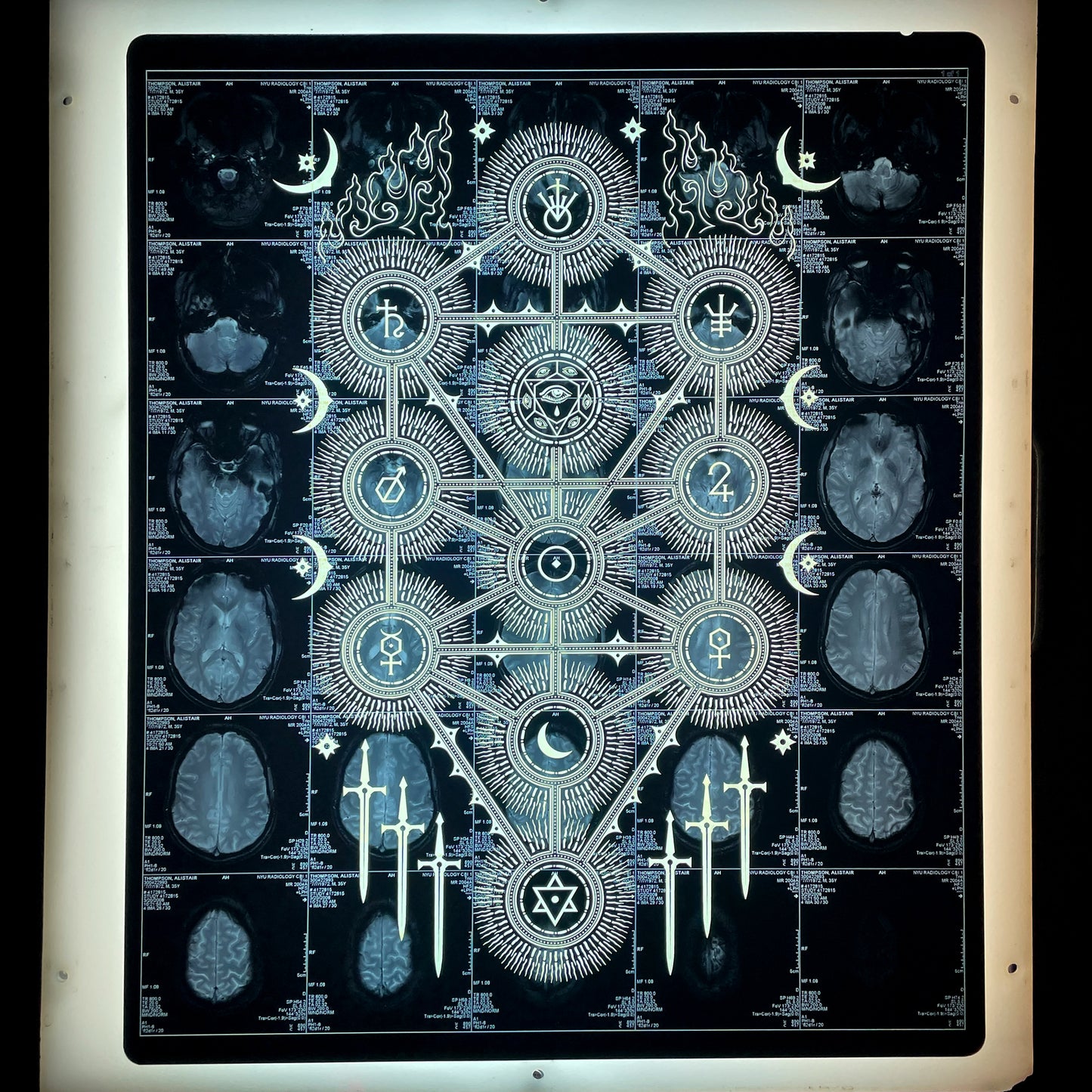 Sephiroth Laser Etched MRI Print 1