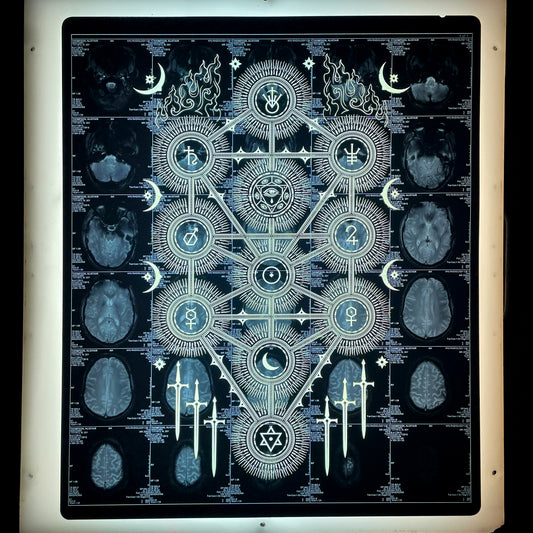 Sephiroth Laser Etched MRI Print 1