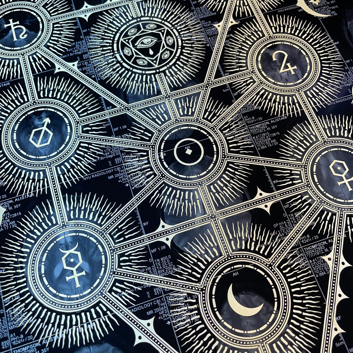 Sephiroth Laser Etched MRI Print 1