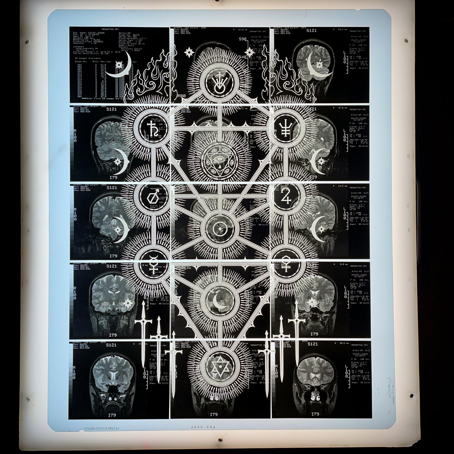 Sephiroth Laser Etched MRI Print 2