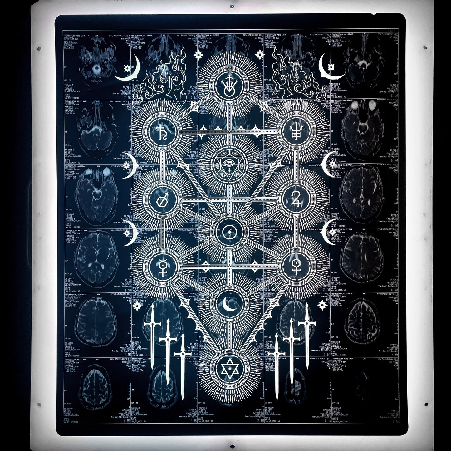 Sephiroth Laser Etched MRI Print 3