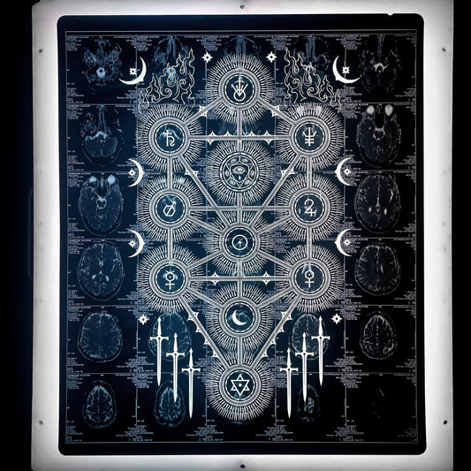 Sephiroth Laser Etched MRI Print 3