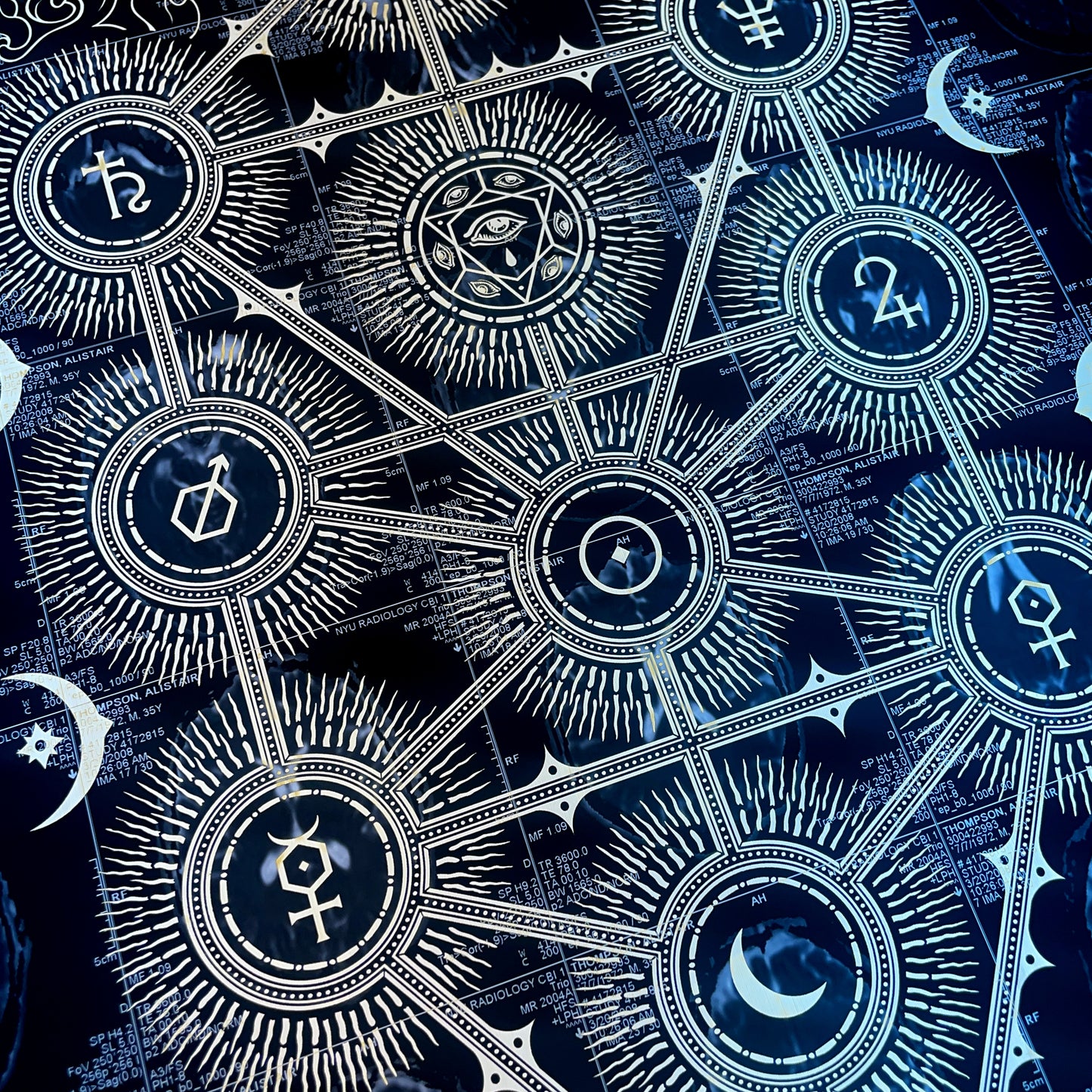 Sephiroth Laser Etched MRI Print 3