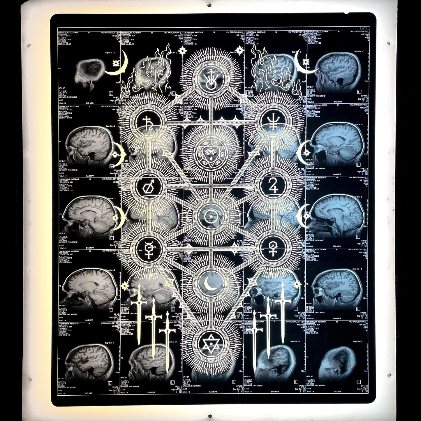 Sephiroth Laser Etched MRI Print 4