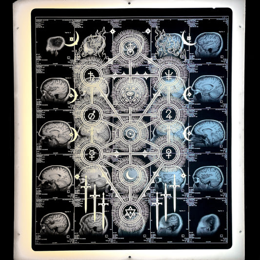 Sephiroth Laser Etched MRI Print 4